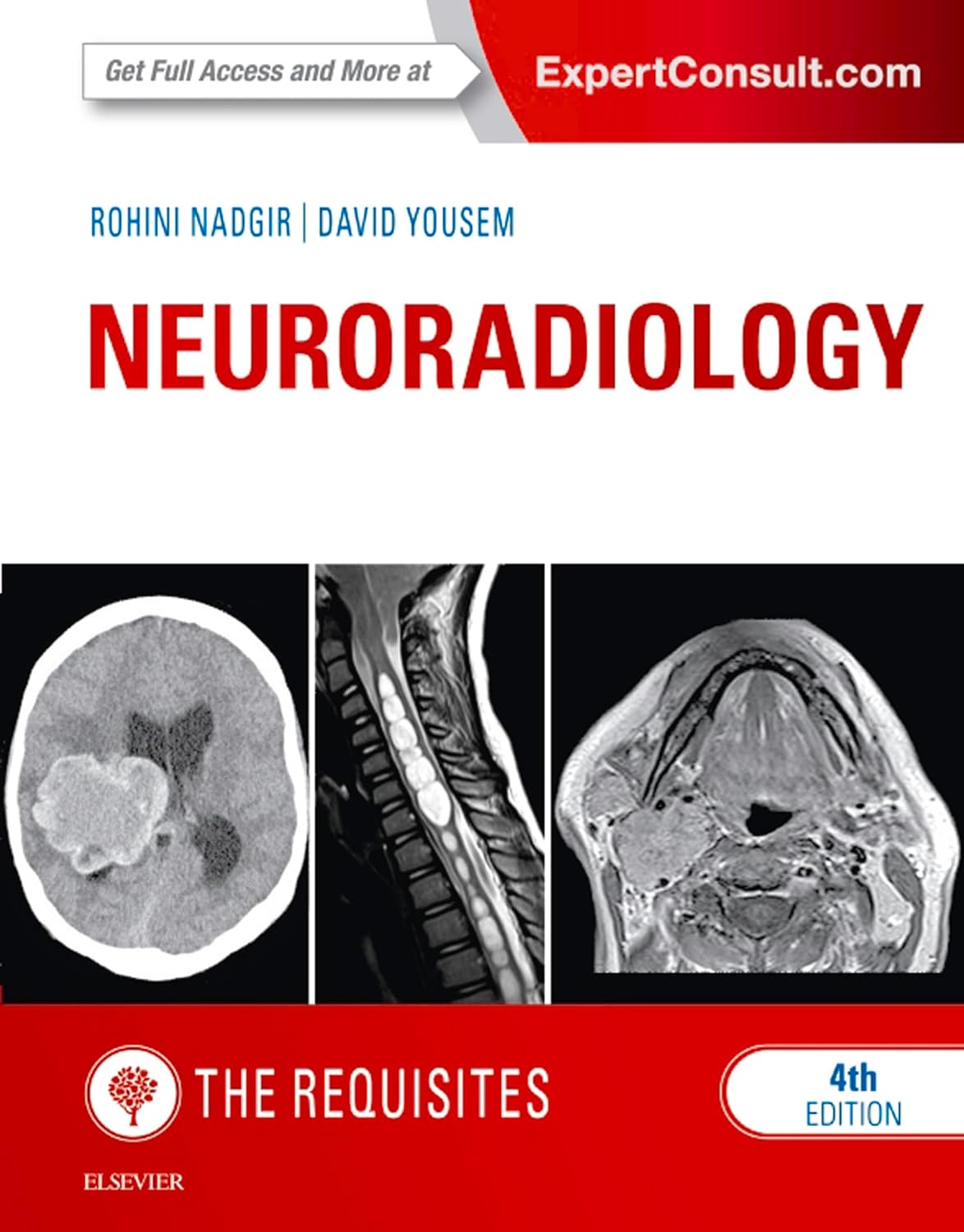 Neuroradiology: The Requisites E-Book (The Core Requisites) (PDF/EPUB Version)