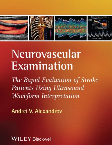 Neurovascular Examination: The Rapid Evaluation of Stroke Patients Using Ultrasound Waveform Interpretation (PDF/EPUB Version)