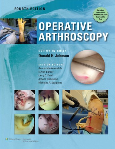 Operative Arthroscopy (PDF/EPUB Version)