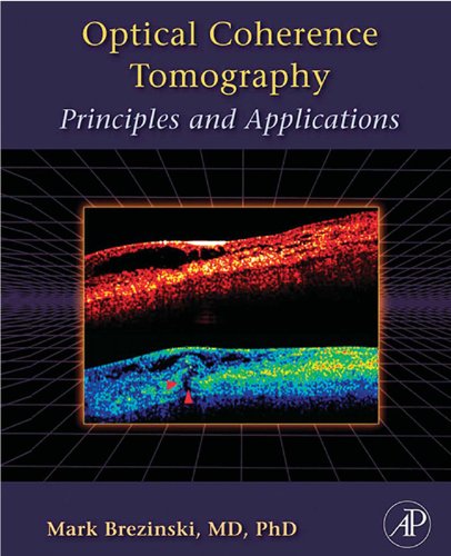 Optical Coherence Tomography: Principles and Applications (PDF/EPUB Version)