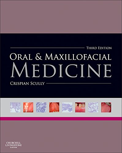Oral and Maxillofacial Medicine: The Basis of Diagnosis and Treatment (PDF/EPUB Version)