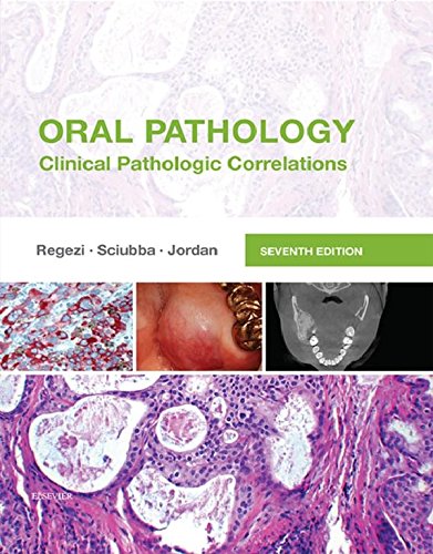 Oral Pathology - E-Book (PDF/EPUB Version)