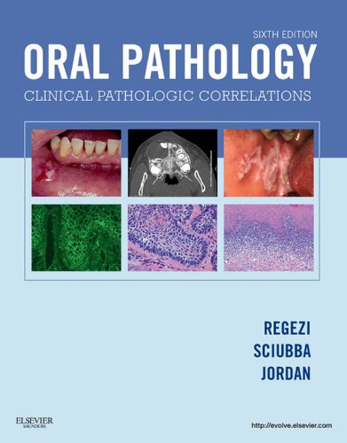 Oral Pathology - E-Book (PDF/EPUB Version)