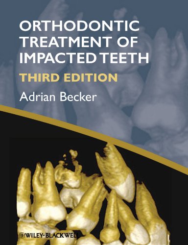 Orthodontic Treatment of Impacted Teeth (PDF/EPUB Version)