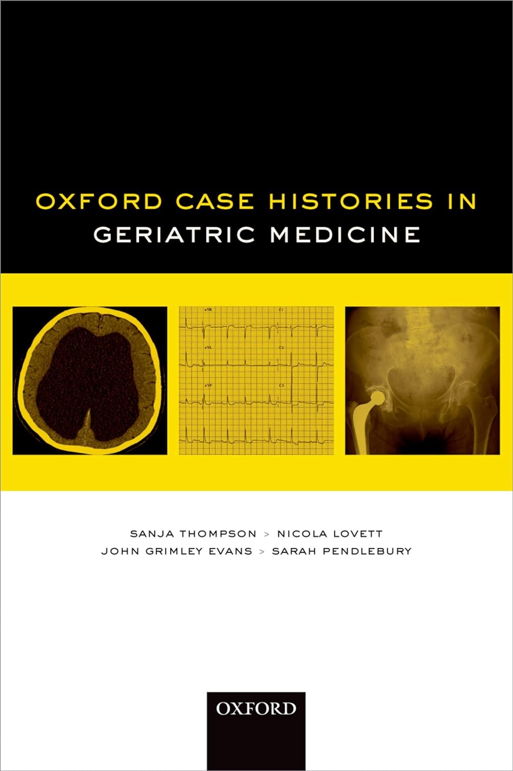 Oxford Case Histories in Geriatric Medicine (PDF/EPUB Version)