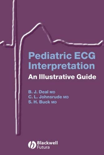 Pediatric ECG Interpretation: An Illustrative Guide (PDF/EPUB Version)