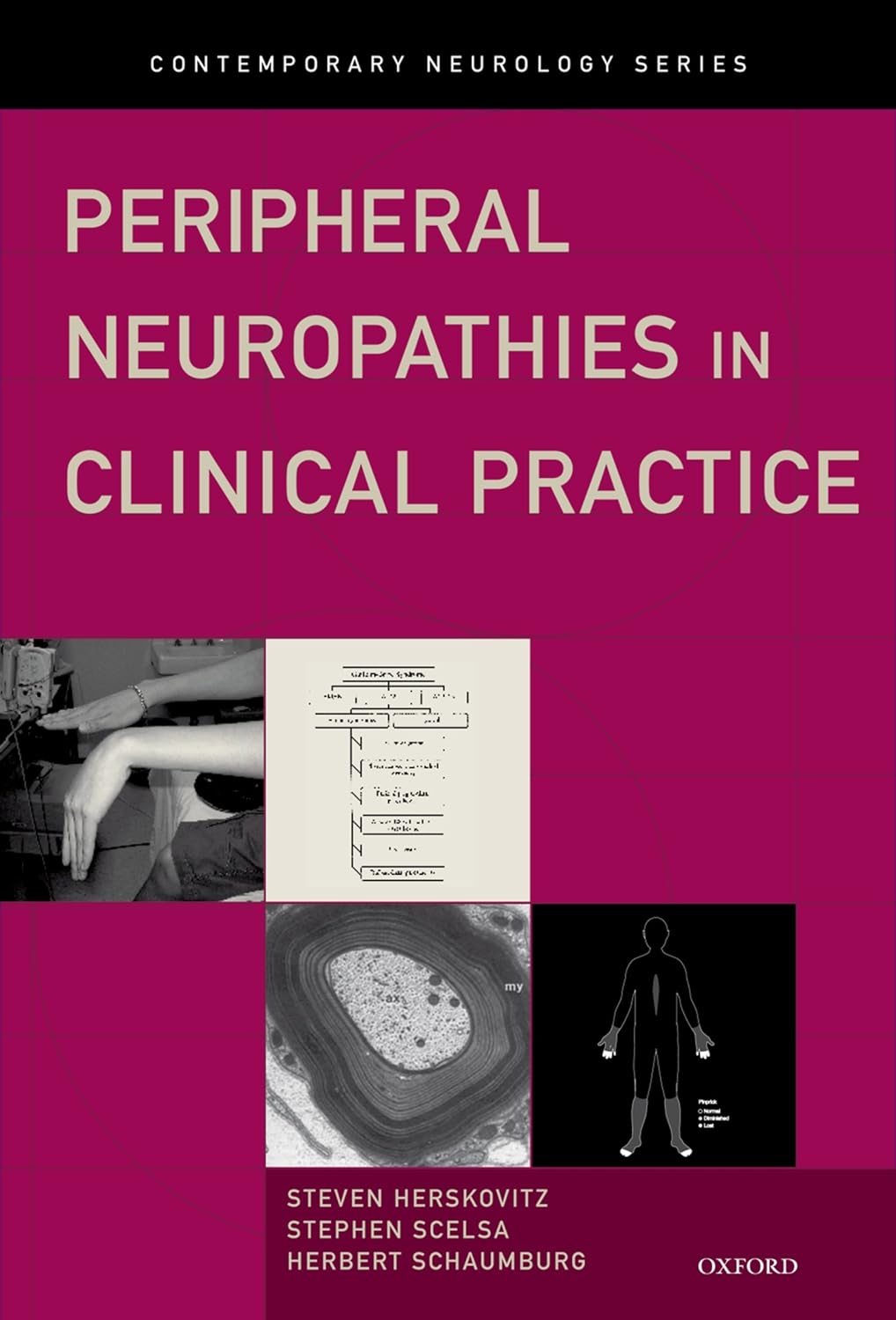 Peripheral Neuropathies in Clinical Practice (Contemporary Neurology Series Book 76) (PDF/EPUB Version)