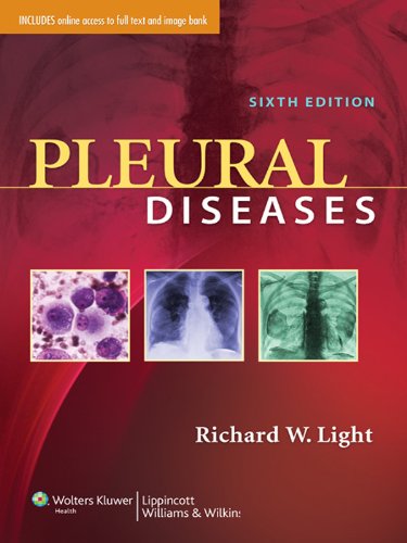 Pleural Diseases (PDF/EPUB Version)