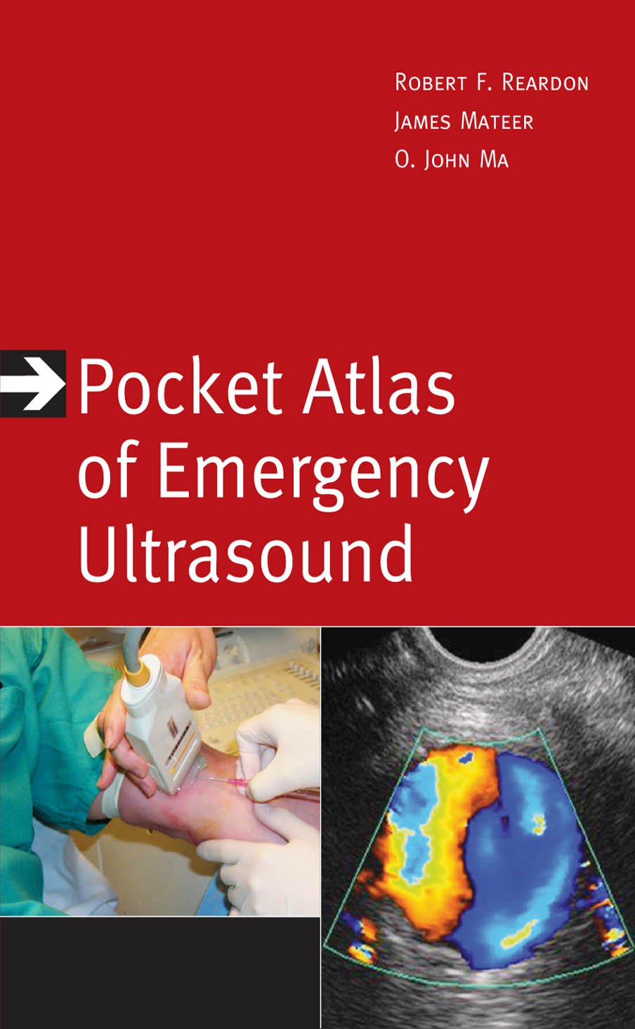 Pocket Atlas of Emergency Ultrasound (Atlas Series) (PDF/EPUB Version)