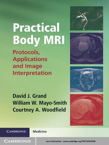 Practical Body MRI: Protocols, Applications and Image Interpretation (PDF/EPUB Version)