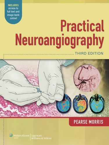 Practical Neuroangiography (PDF/EPUB Version)