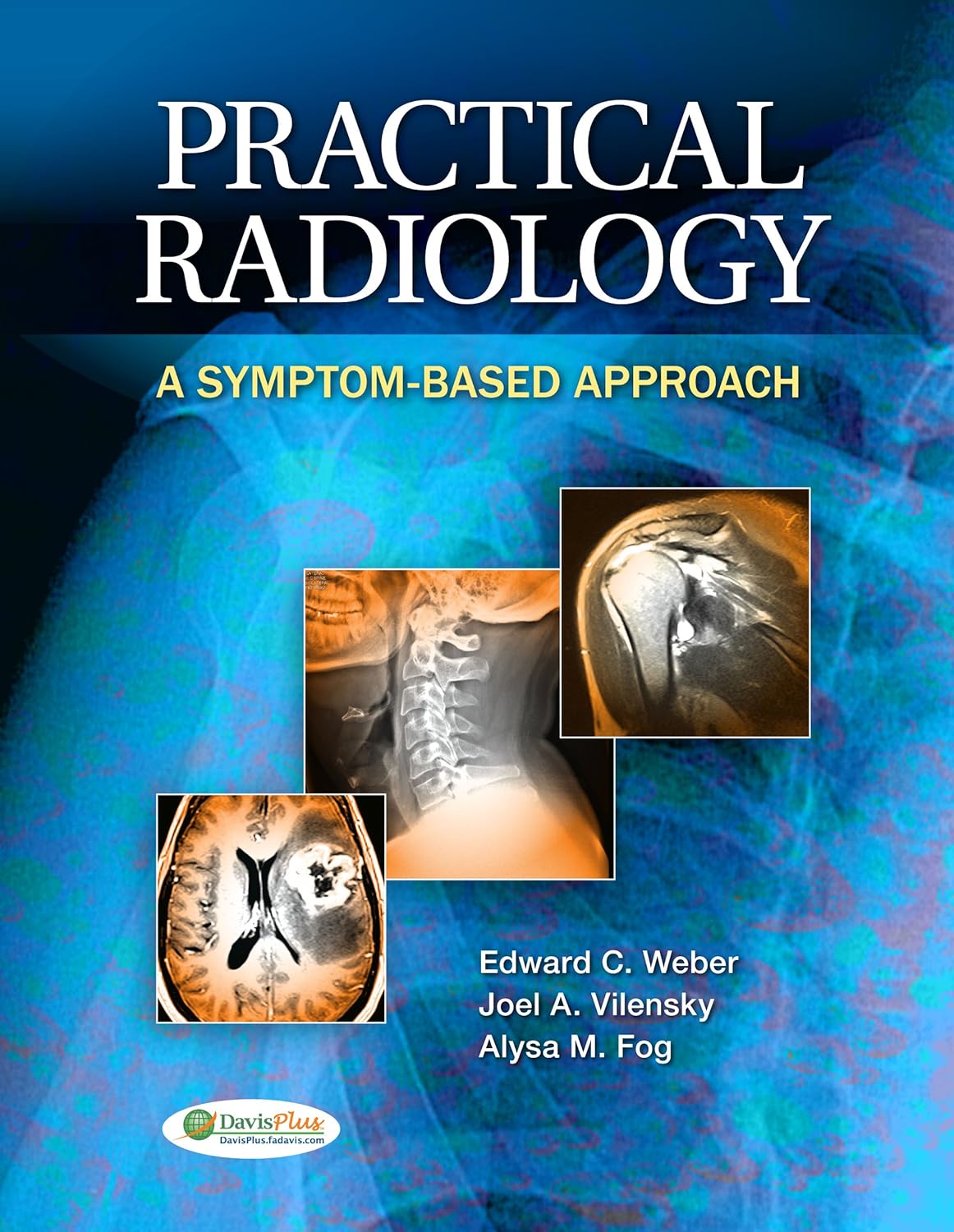 Practical Radiology A Symptom Based Approach: A Symptom-Based Approach (PDF/EPUB Version)