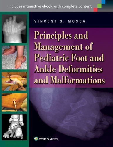 Principles and Management of Pediatric Foot and Ankle Deformities and Malformations (PDF/EPUB Version)