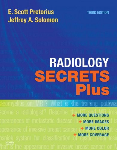 Radiology Secrets Plus E-Book (PDF/EPUB Version)