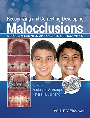 Recognizing and Correcting Developing Malocclusions: A Problem-Oriented Approach to Orthodontics (PDF/EPUB Version)