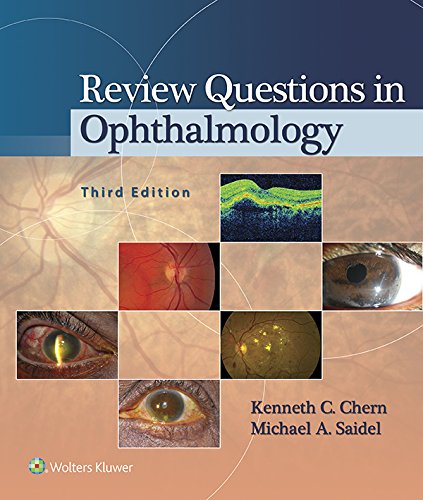 Review Questions in Ophthalmology (PDF/EPUB Version)