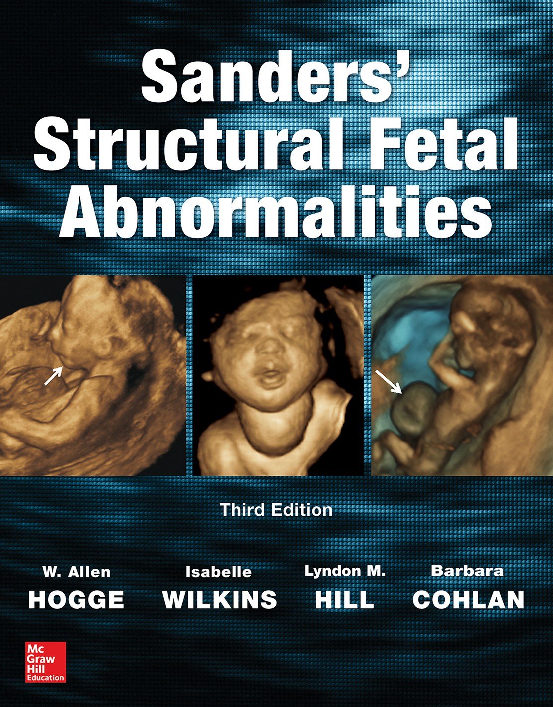 Sanders' Structural Fetal Abnormalities, Third Edition (PDF/EPUB Version)