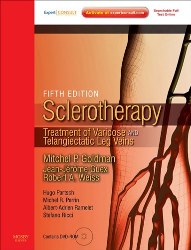 Sclerotherapy E-Book: Treatment of Varicose and Telangiectatic Leg Veins (PDF/EPUB Version)