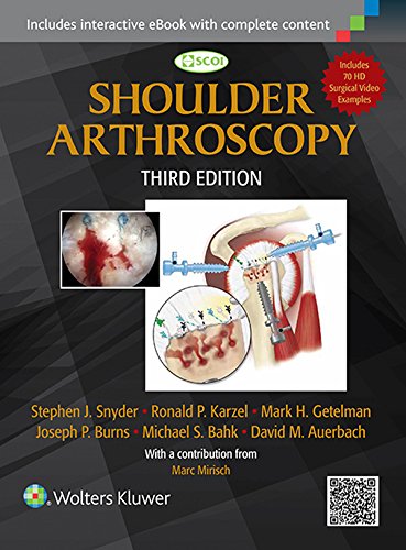 Shoulder Arthroscopy (PDF/EPUB Version)