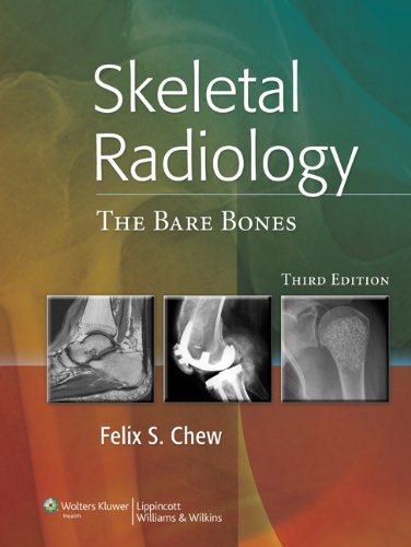 Skeletal Radiology: The Bare Bones (PDF/EPUB Version)