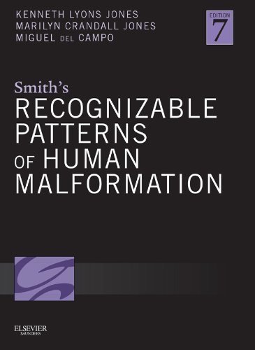 Smith's Recognizable Patterns of Human Malformation: Expert Consult - Online and Print (PDF/EPUB Version)