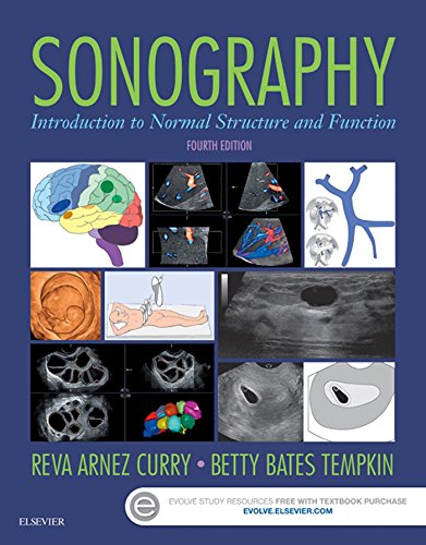 Sonography - E-Book (PDF/EPUB Version)