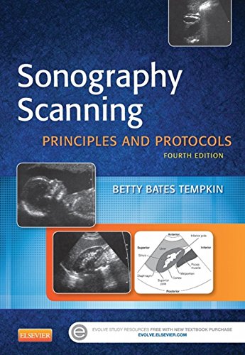 Sonography Scanning - E-Book (Ultrasound Scanning) (PDF/EPUB Version)