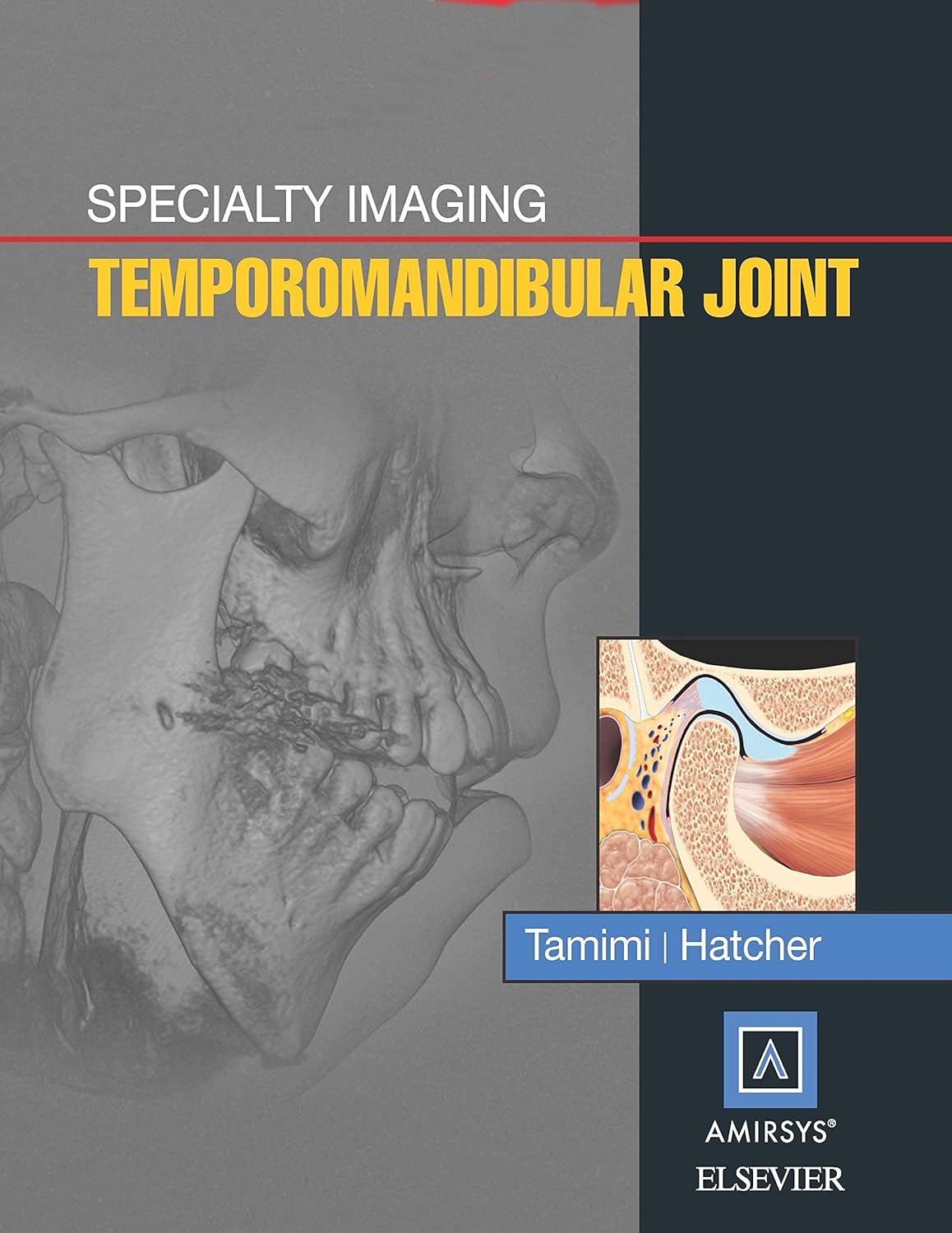 Specialty Imaging: Temporomandibular Joint E-Book (PDF/EPUB Version)