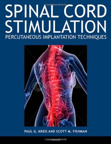 Spinal Cord Stimulation Implantation: Percutaneous Implantation Techniques (PDF/EPUB Version)
