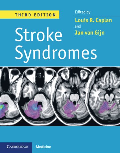Stroke Syndromes (PDF/EPUB Version)