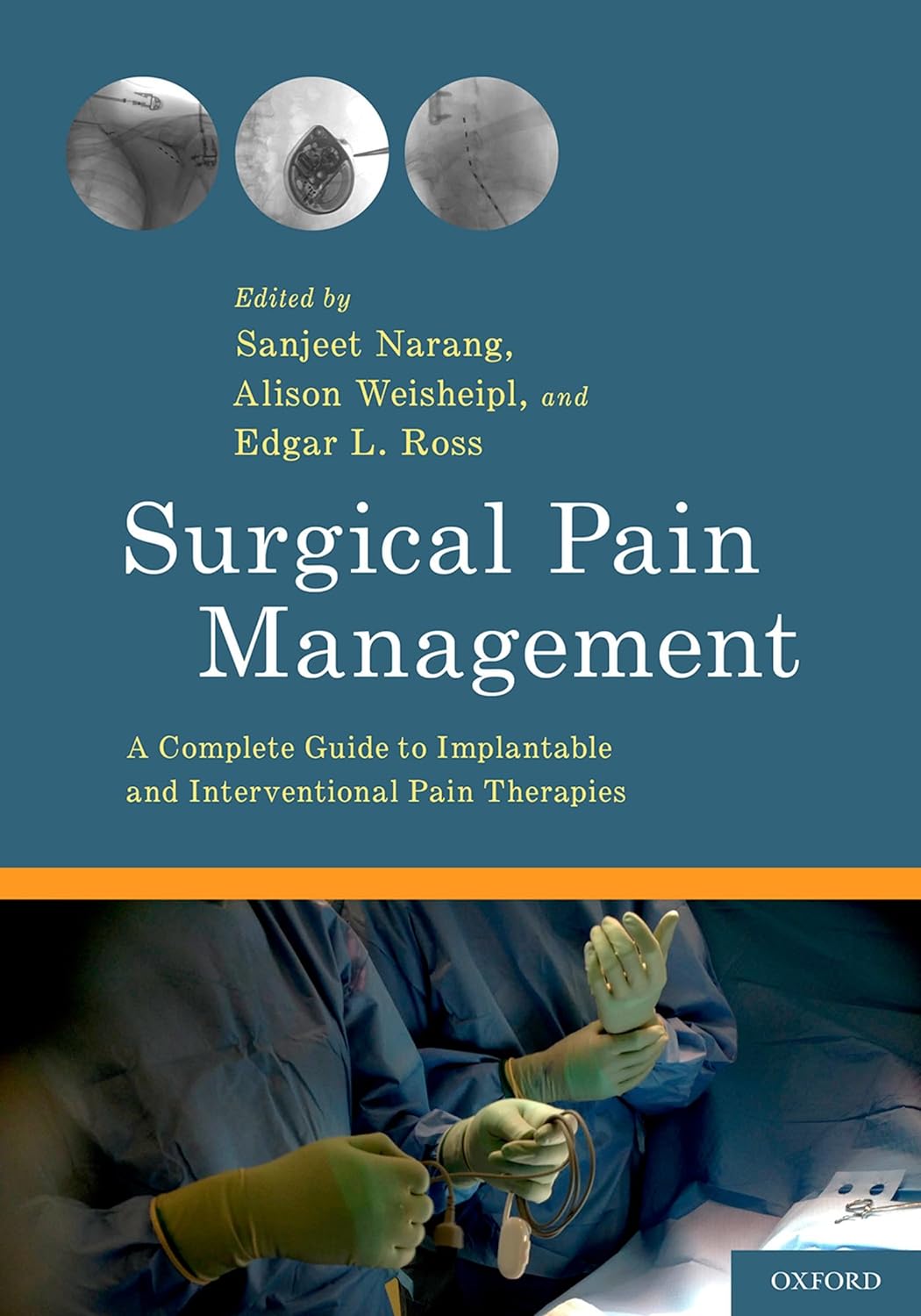 Surgical Pain Management: A Complete Guide to Implantable and Interventional Pain Therapies (PDF/EPUB Version)