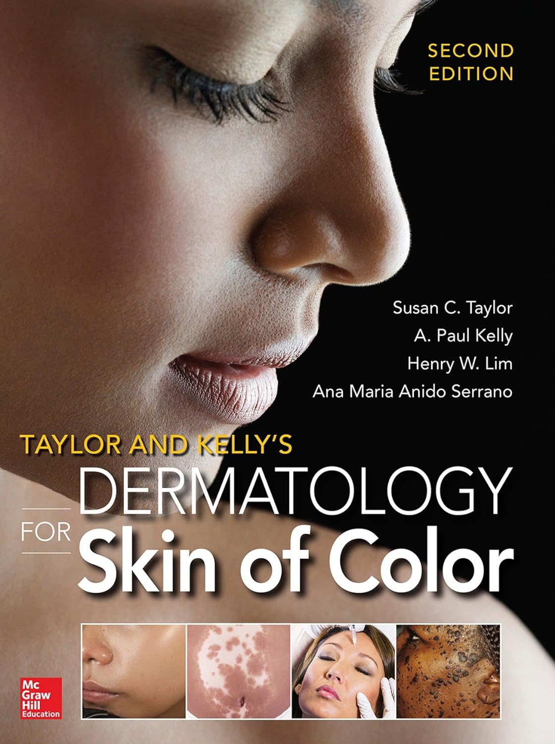 Taylor and Kelly's Dermatology for Skin of Color 2/E (PDF/EPUB Version)
