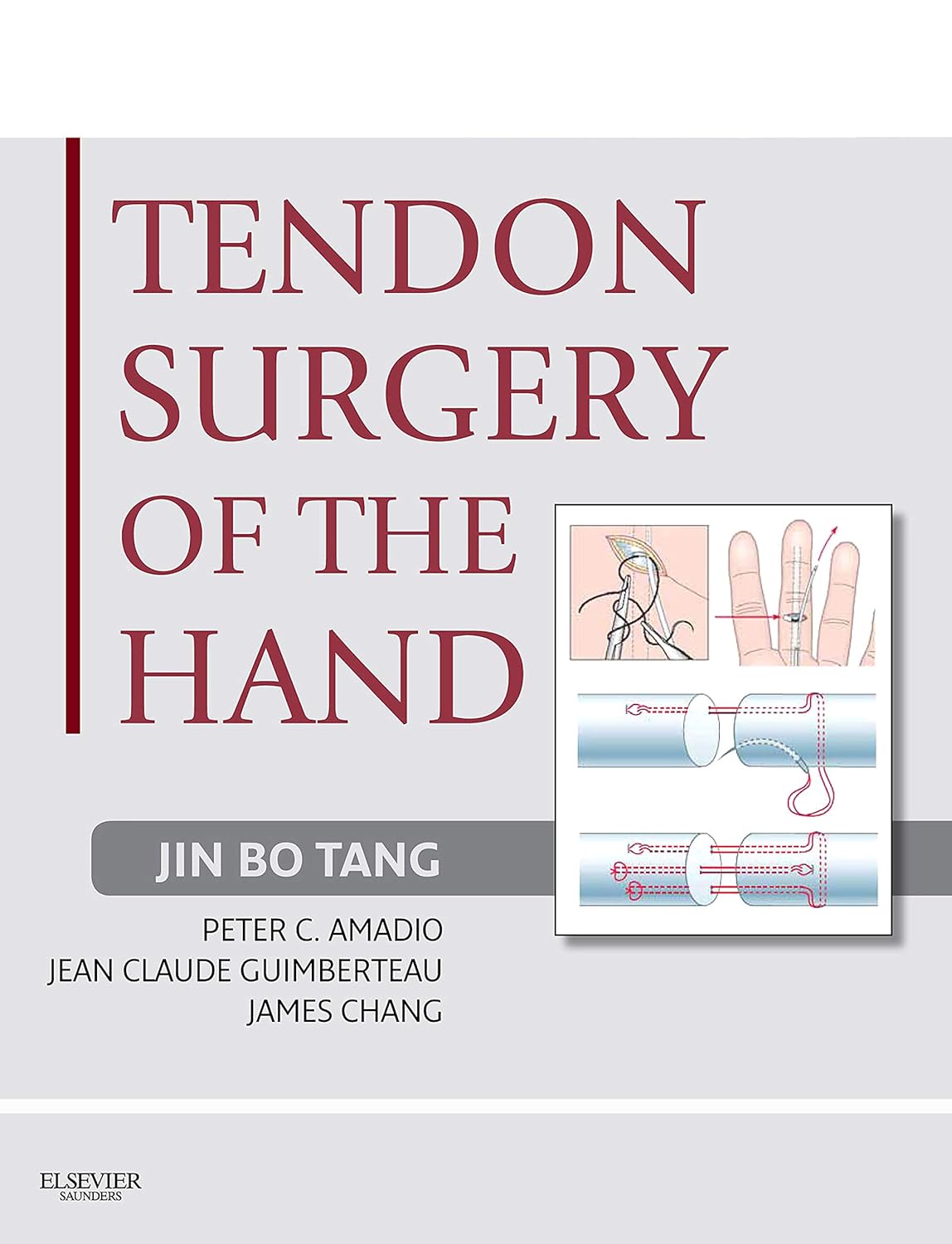 Tendon Surgery of the Hand E-Book: Expert Consult - Online and Print (PDF/EPUB Version)