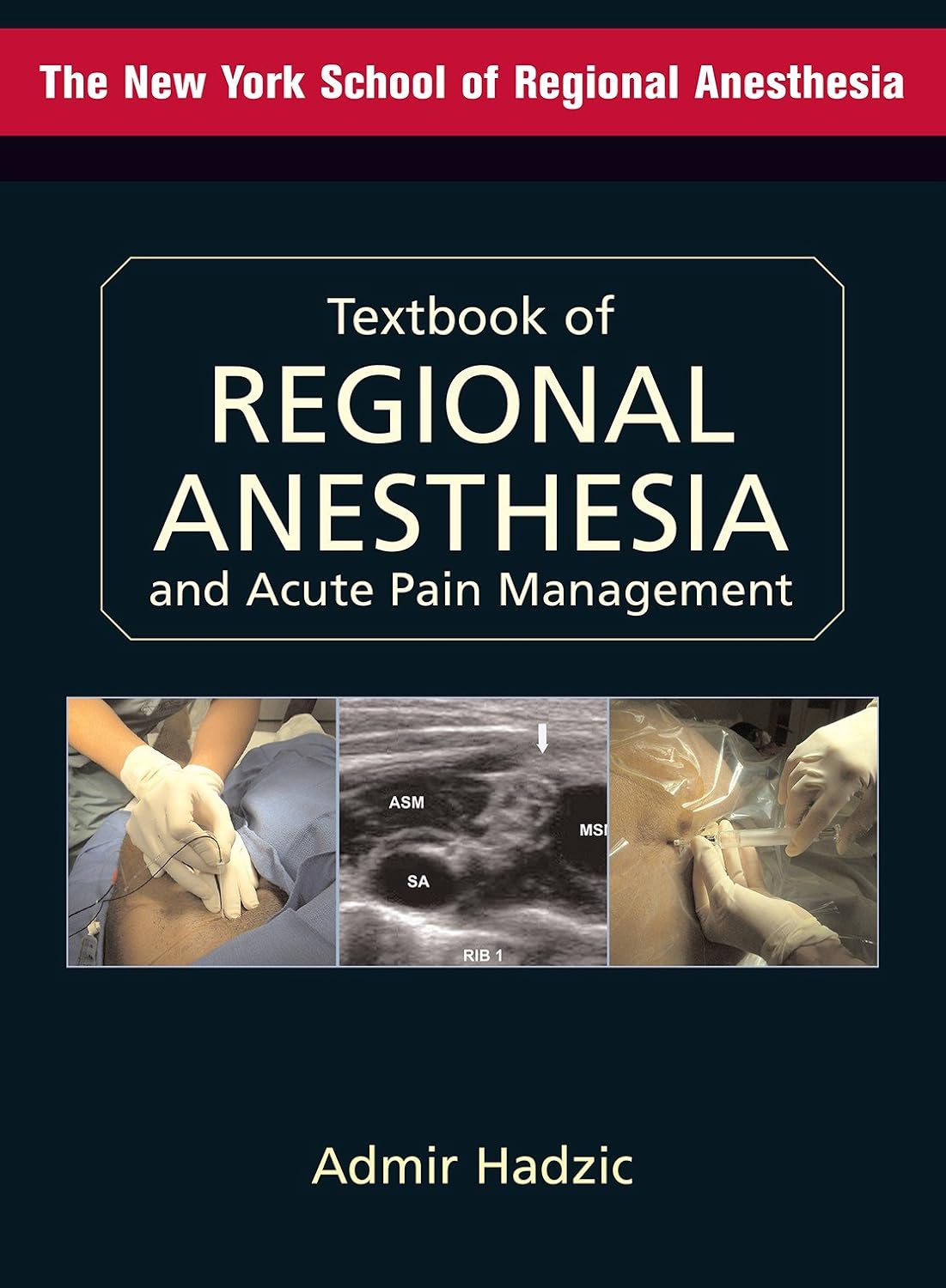 Textbook of Regional Anesthesia and Acute Pain Management (Hadzic, Textbook of Regional Anesthesia and Acute Pain Management) (PDF/EPUB Version)