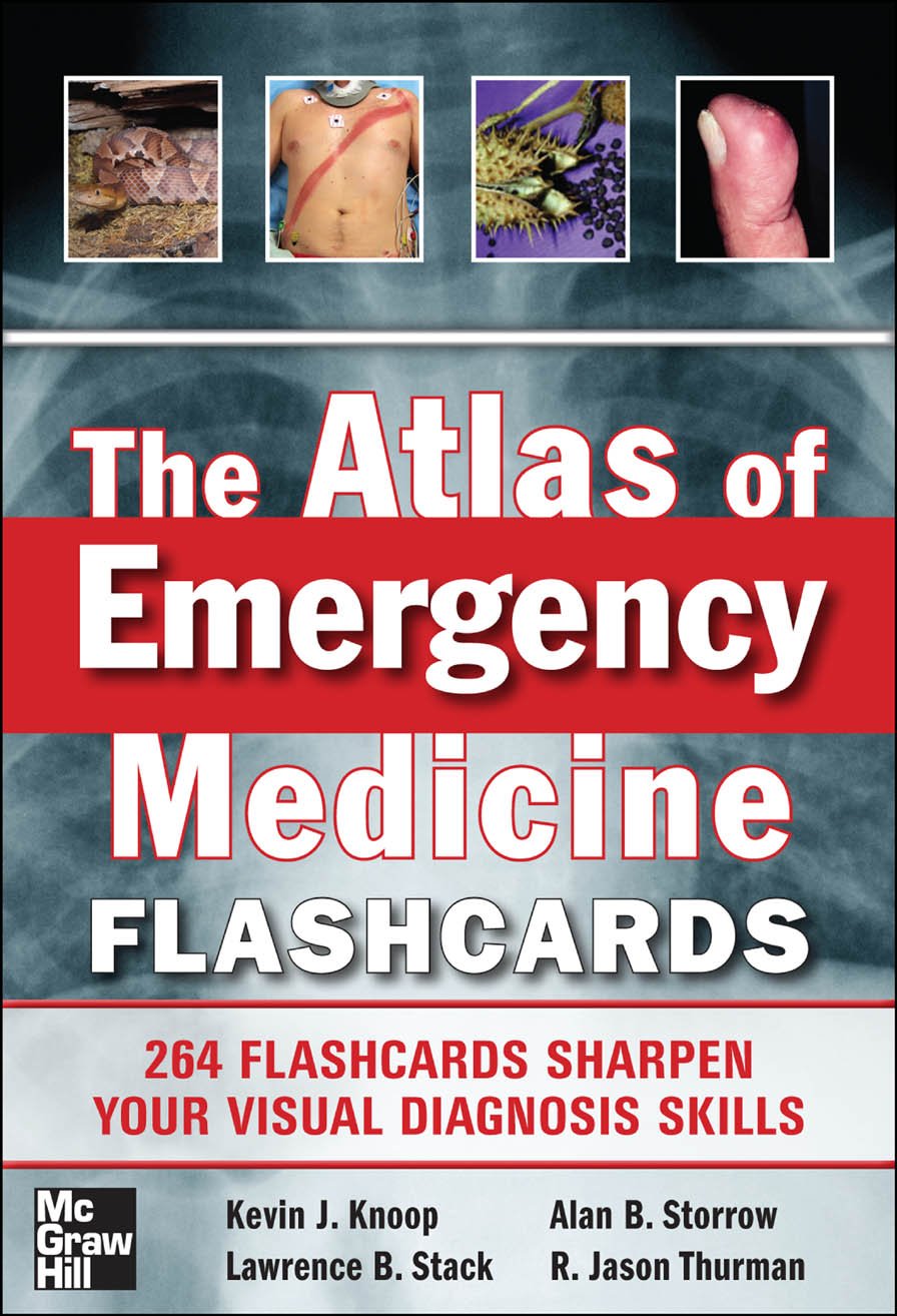 The Atlas of Emergency Medicine Flashcards (PDF/EPUB Version)