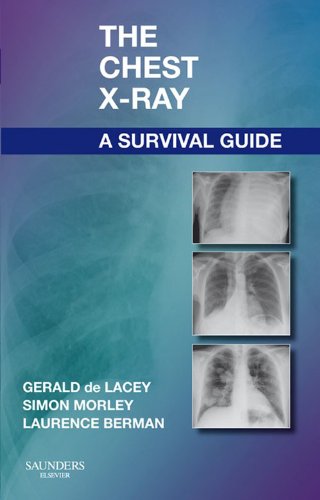 The Chest X-Ray: A Survival Guide (PDF/EPUB Version)