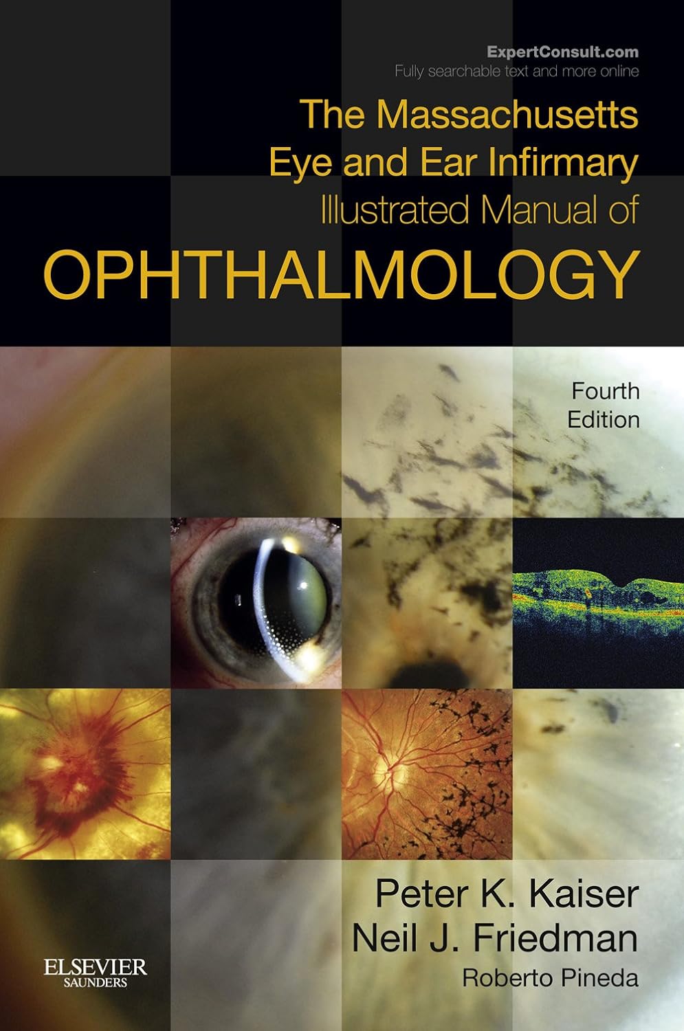 The Massachusetts Eye and Ear Infirmary Illustrated Manual of Ophthalmology E-Book (PDF/EPUB Version)
