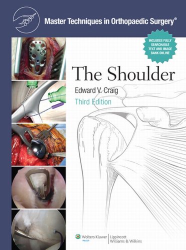 The Master Techniques in Orthopaedic Surgery: Shoulder (PDF/EPUB Version)