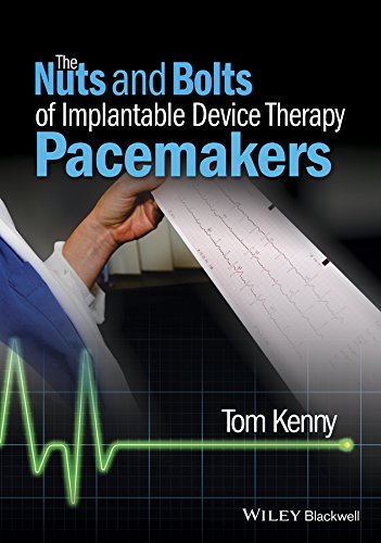 The Nuts and Bolts of Implantable Device Therapy: Pacemakers (The Nuts and Bolts Series) (PDF/EPUB Version)