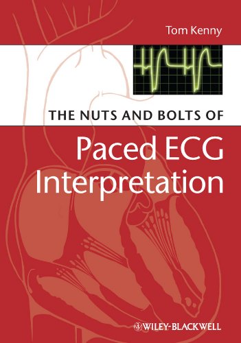 The Nuts and bolts of Paced ECG Interpretation (Nuts and Bolts Series (Replaced by 5113) Book 8) (PDF/EPUB Version)