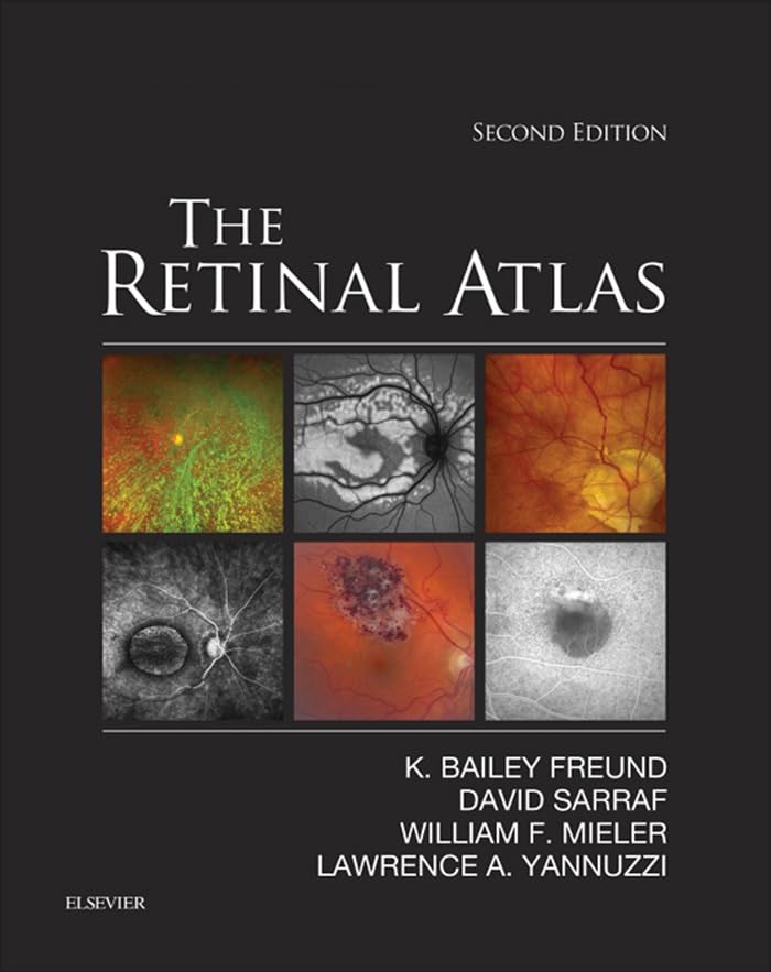 The Retinal Atlas E-Book (PDF/EPUB Version)