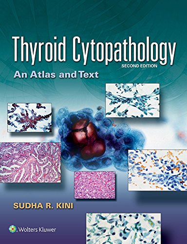Thyroid Cytopathology: An Atlas and Text (PDF/EPUB Version)