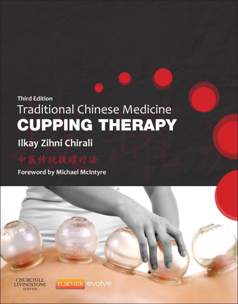 Traditional Chinese Medicine Cupping Therapy - E-Book (PDF/EPUB Version)