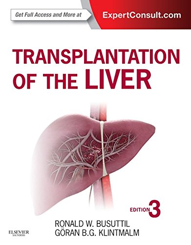 Transplantation of the Liver (PDF/EPUB Version)