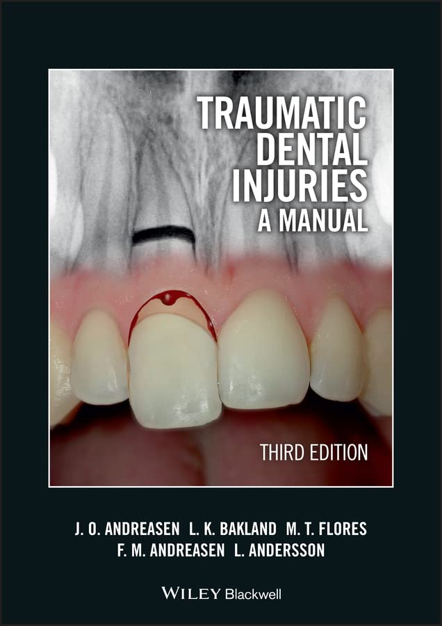Traumatic Dental Injuries: A Manual (PDF/EPUB Version)
