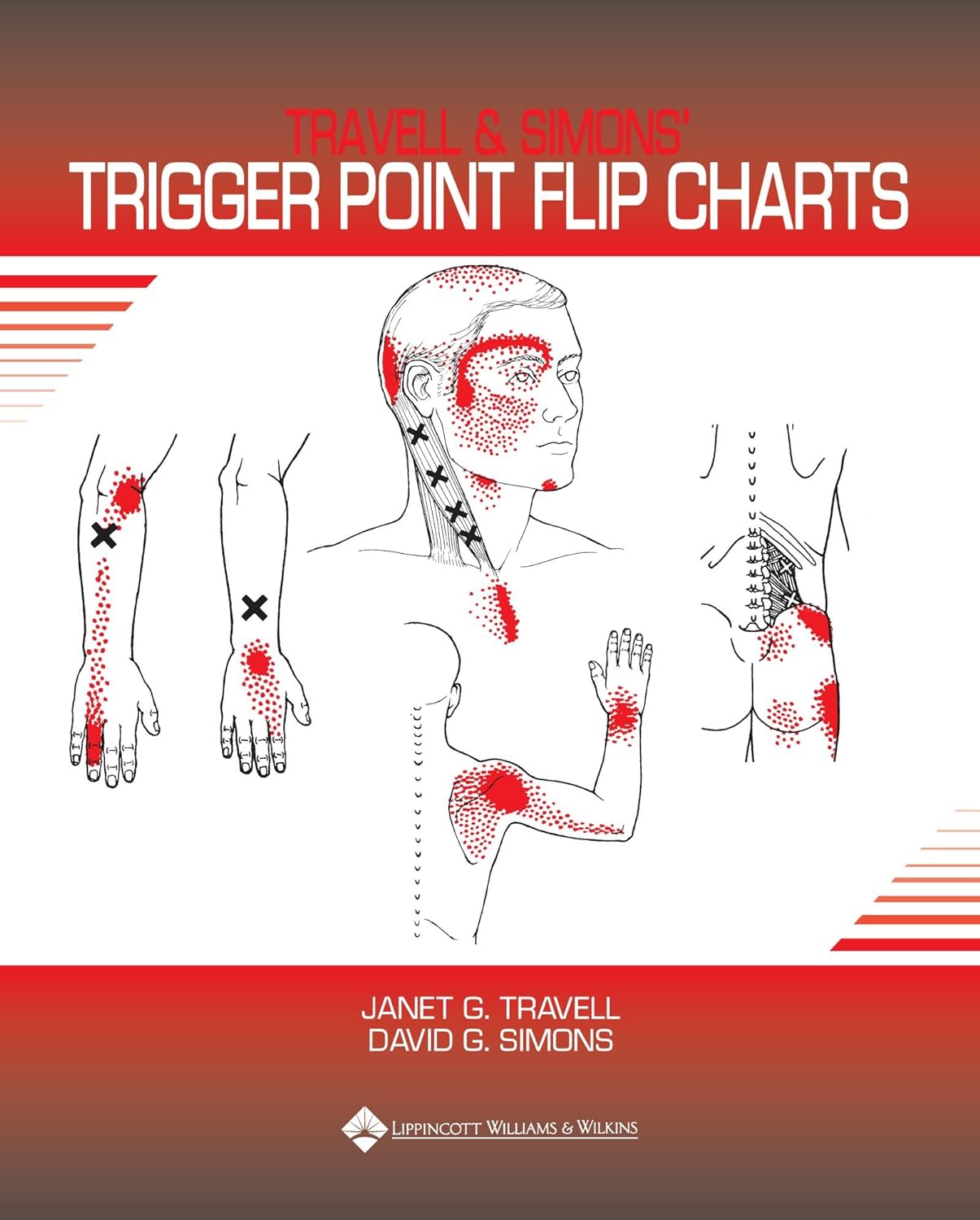 Travell and Simons' Trigger Point Flip Charts (PDF/EPUB Version)