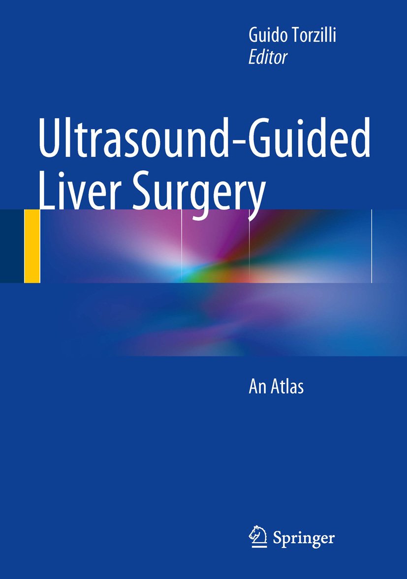 Ultrasound-Guided Liver Surgery: An Atlas (PDF/EPUB Version)