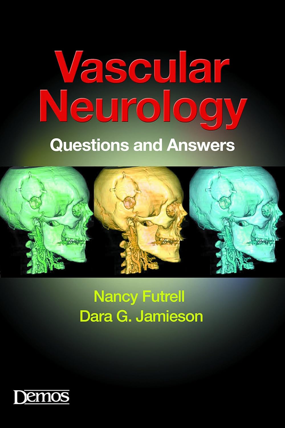 Vascular Neurology: Questions and Answers (PDF/EPUB Version)