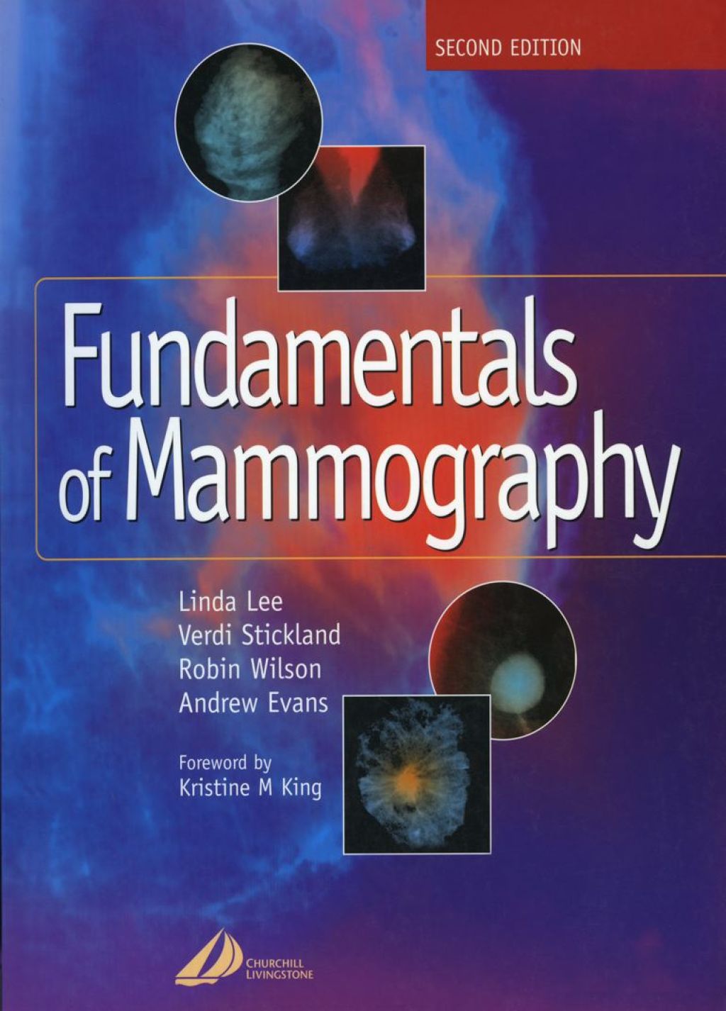 Fundamentals of Mammography 2nd Edition