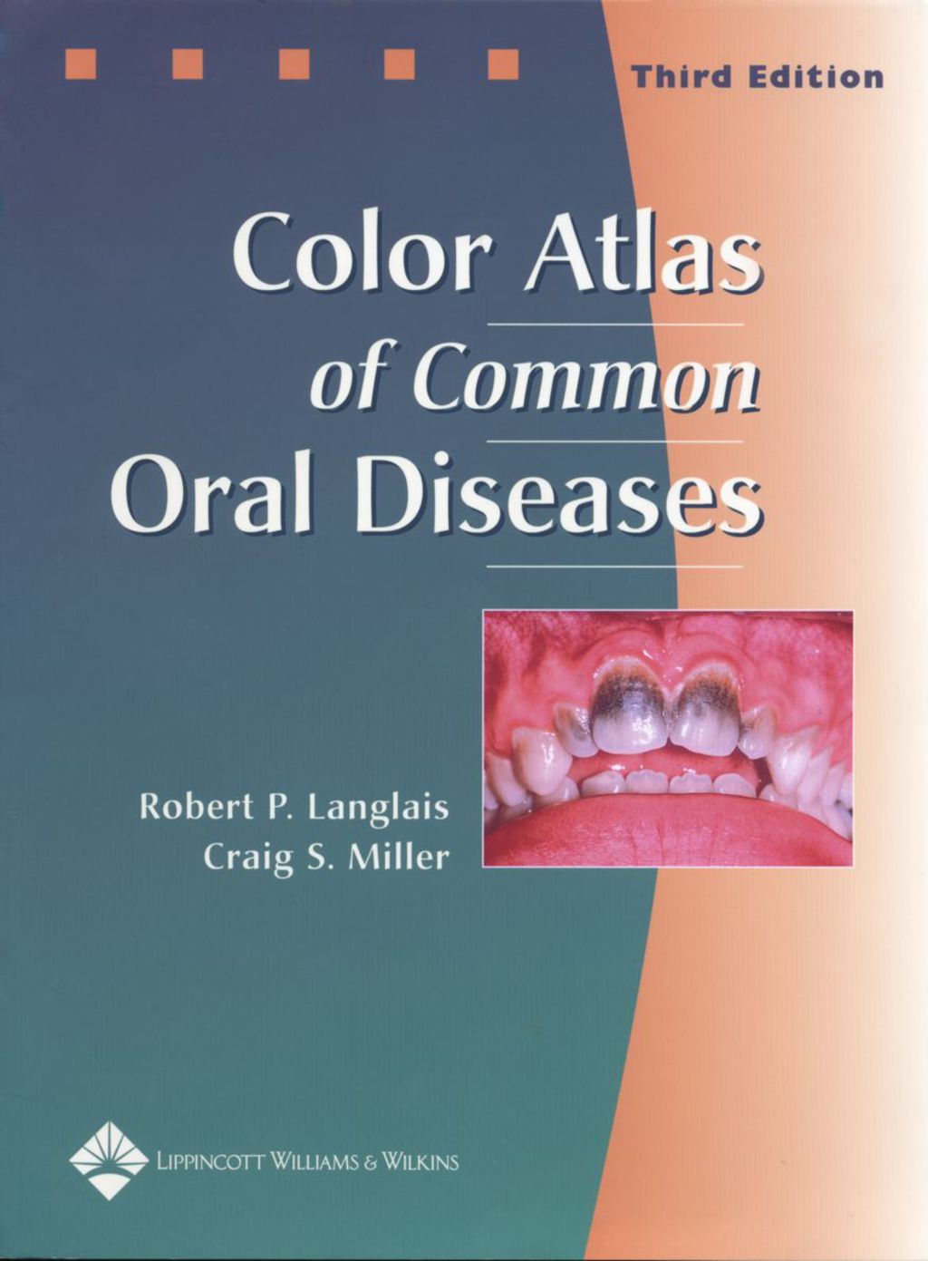 Color Atlas of Common Oral Diseases 3rd Edition